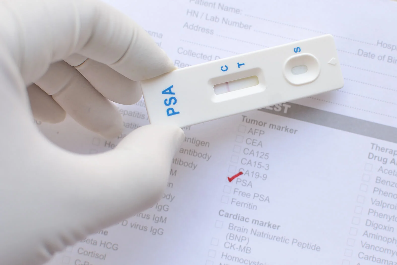 Test preventivo de Cáncer de Próstata