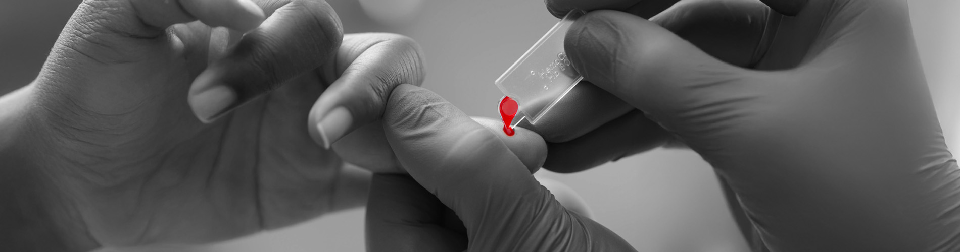 Microcubetas-Hb-801-Hemocue-énKairos