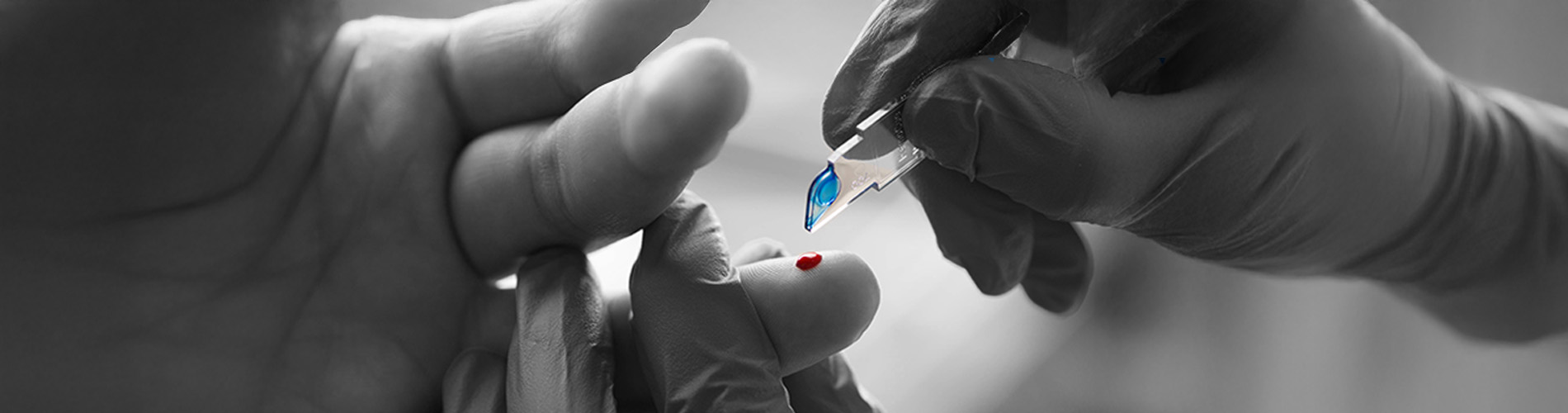 Microcubetas-wbc-diff-Hemocue-énKairos